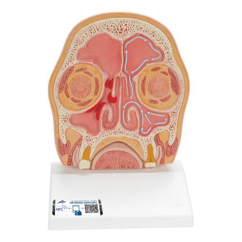 9936 C13 1 01 Kopfmodell frontal geschnitten in anatomischer Hoehe der Nasennebenhoehlen mit Sinusitis 3 B Smart Anatomy