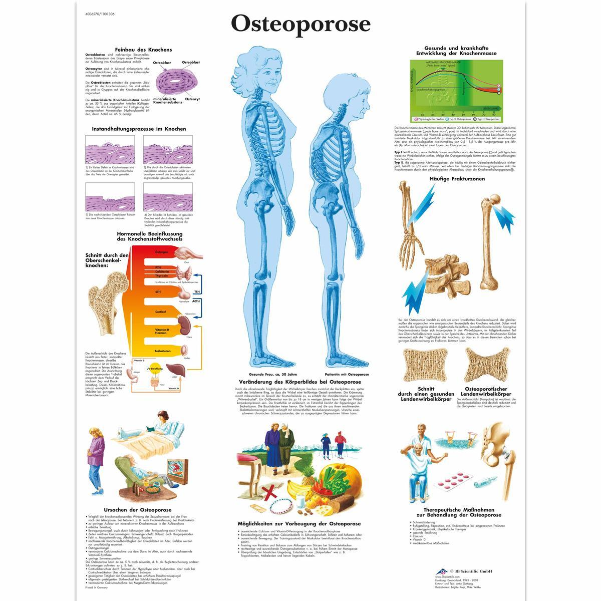 VR0121 UU 01 1200 12004006570 Osteoporose Chart