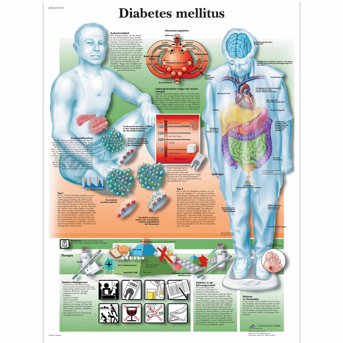 VR0441 L 01 1200 12001001391 Diabetes mellitus Cha