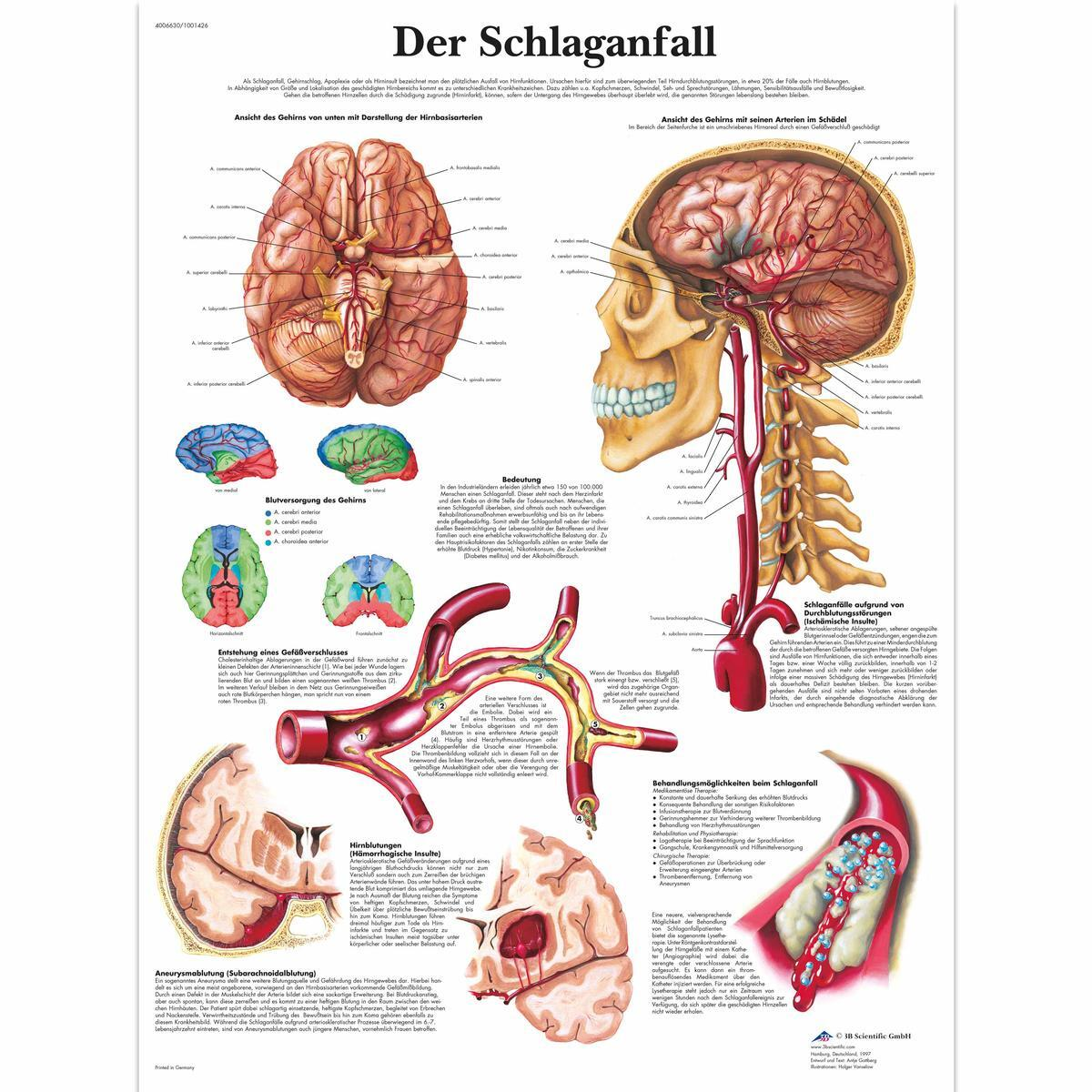 VR0627 UU 01 1200 12004006630 Der Schlaganfall