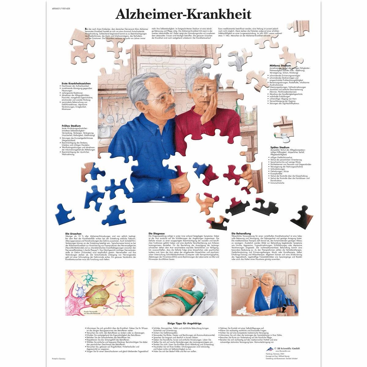 VR0628 UU 01 1200 12004006631 Alzheimer Krankheit