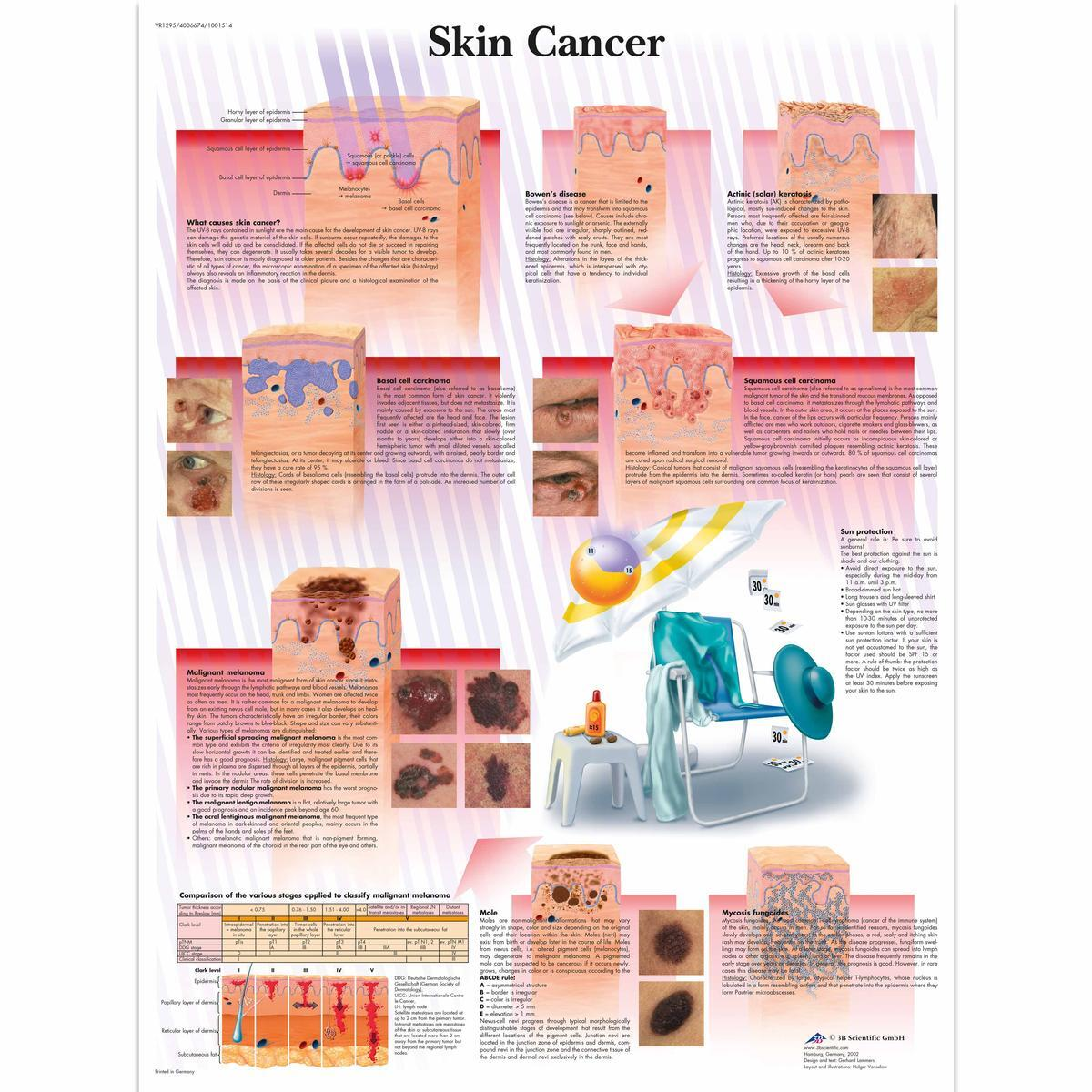 VR1295 L 01 1200 12001001514 Skin Cancer Chart