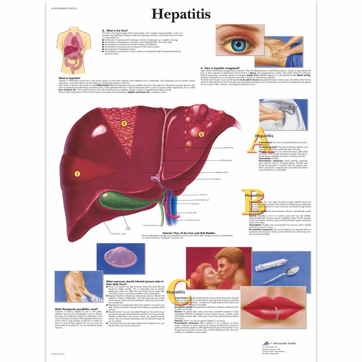 VR1435 UU 01 1200 12004006693 Hepatitis Chart