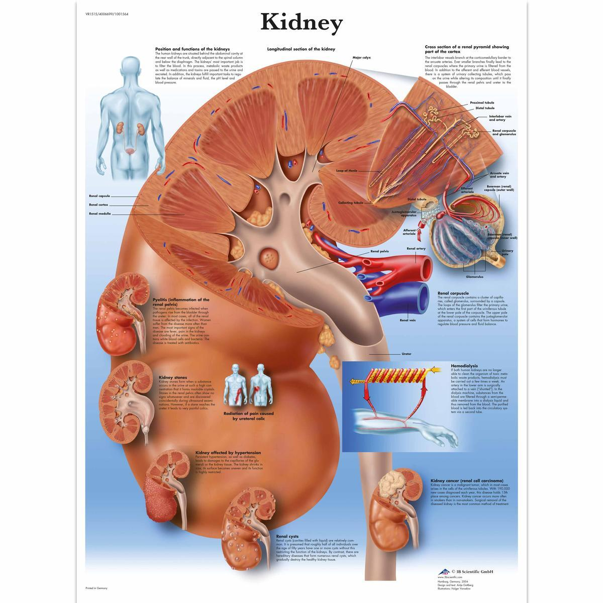 VR1515 UU 01 1200 12004006699 Kidney Chart