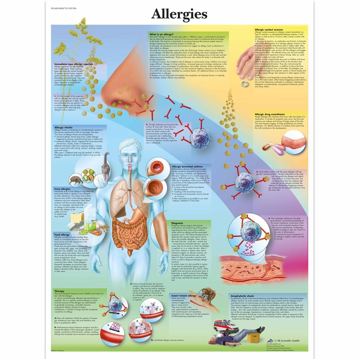 VR1660 UU 01 1200 12004006715 Allergies Chart