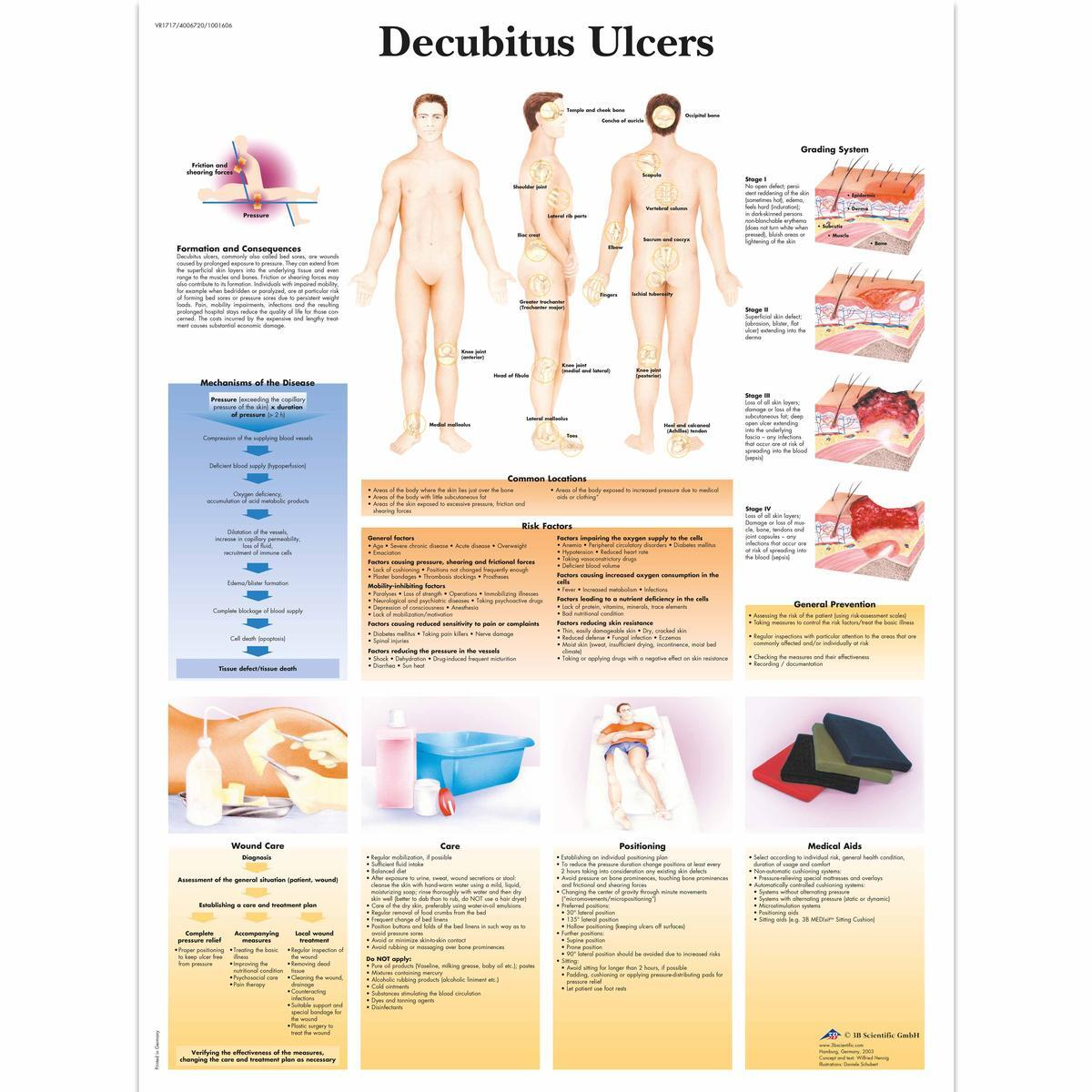 VR1717 UU 01 1200 12004006720 Decubitus Ulcers Cha