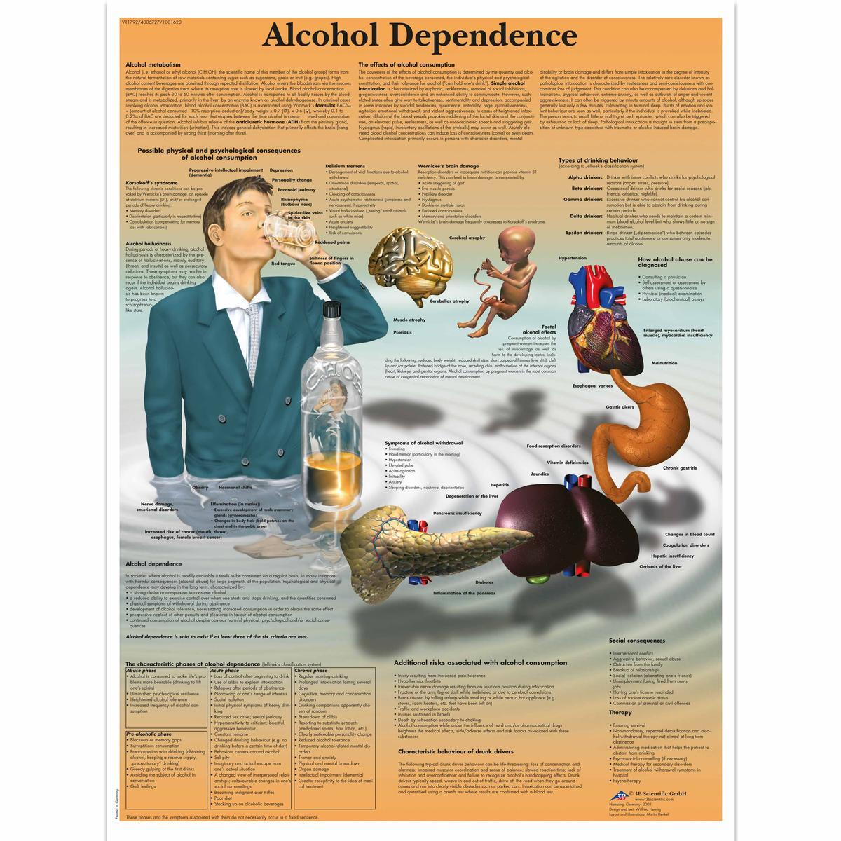 VR1792 L 01 1200 12001001620 Alcohol Dependence Ch