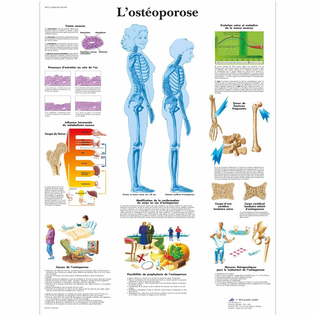 VR2121 UU 01 1200 12004006734 Lost eacuteoporose