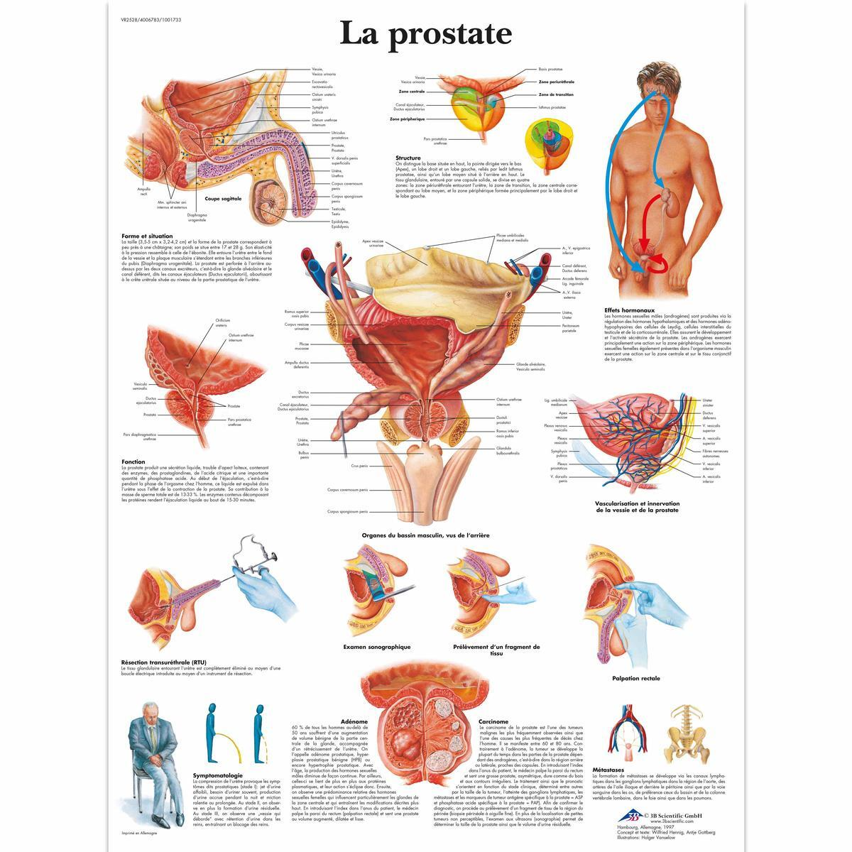 VR2528 UU 01 1200 12004006783 La prostate