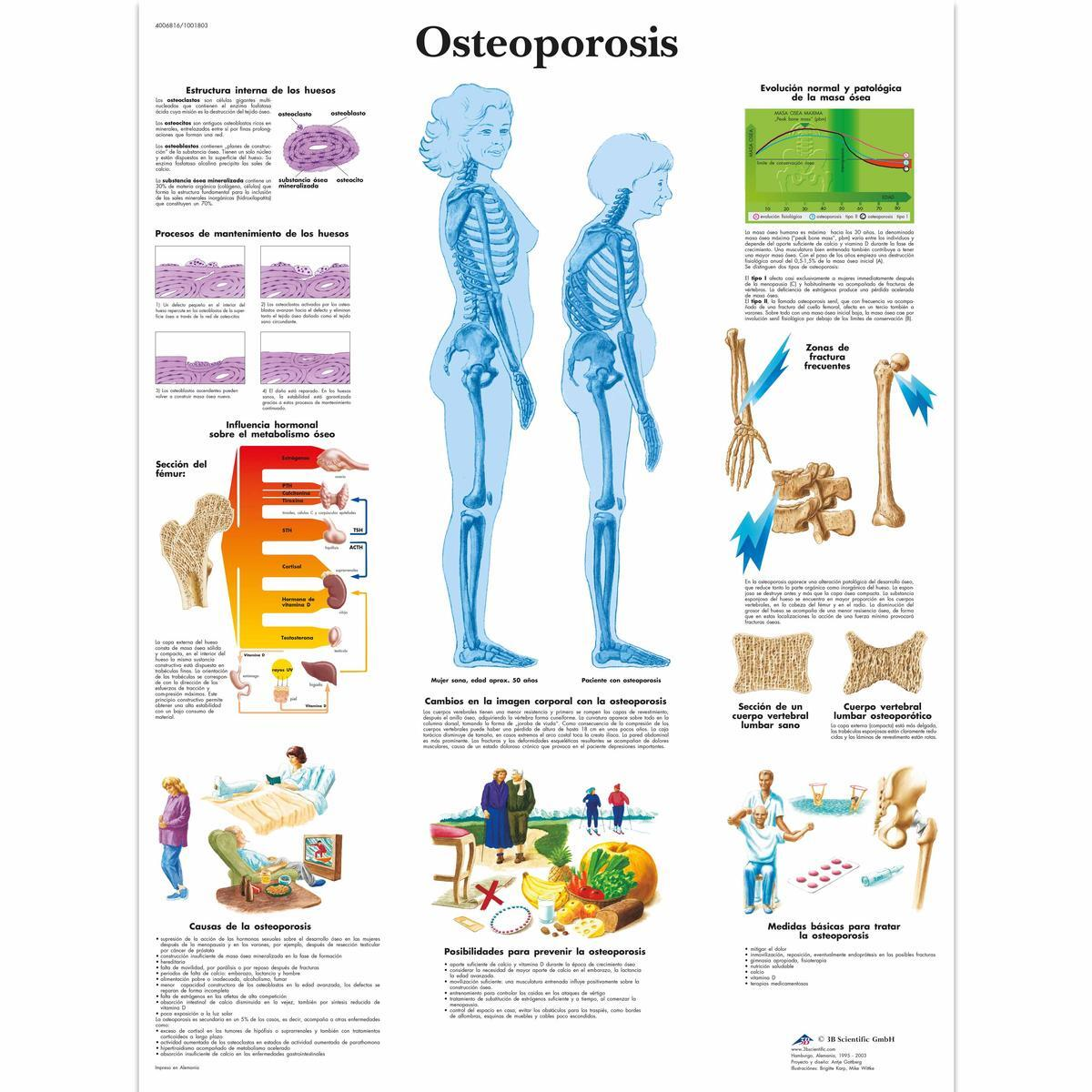 VR3121 L 01 1200 12001001803 Osteoporosis