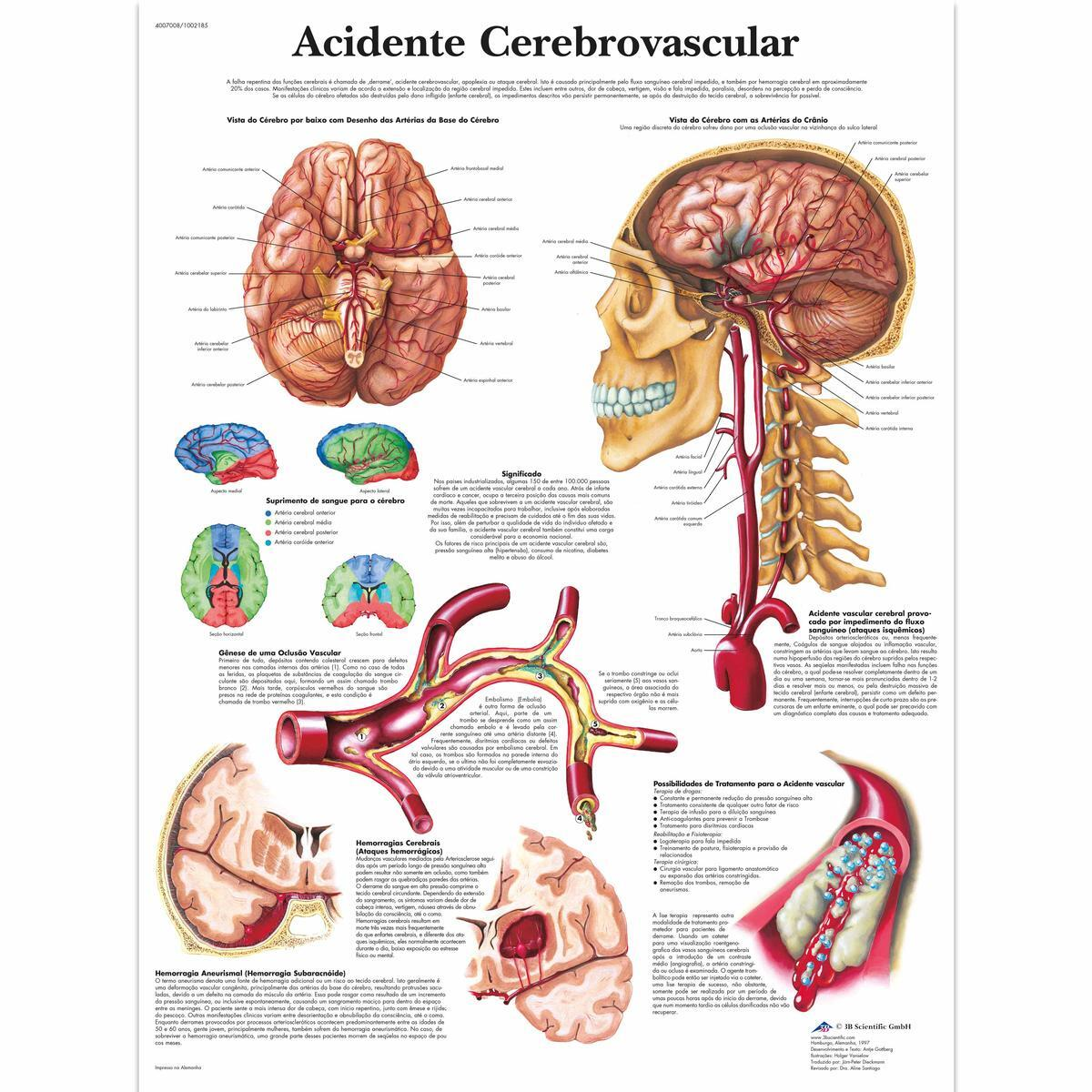 VR5627 UU 01 1200 12004007008 Acid Cerebrovascula