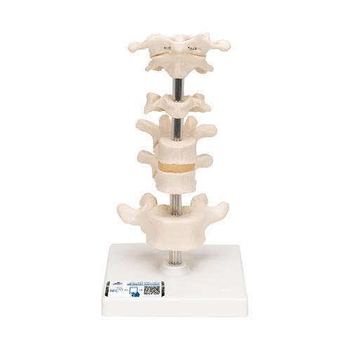 11384 A75 01 6 Wirbelmodelle auf Stativ 3 B Smart Anatomy