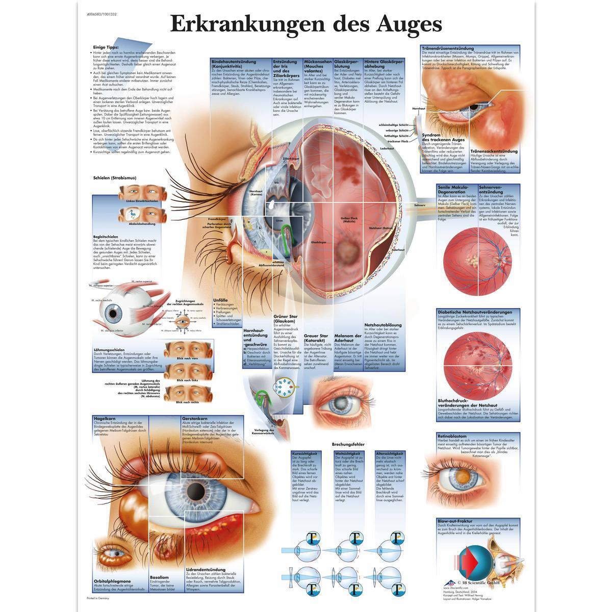 VR0231 L 01 1200 12001001332 Erkrankungen des Auge