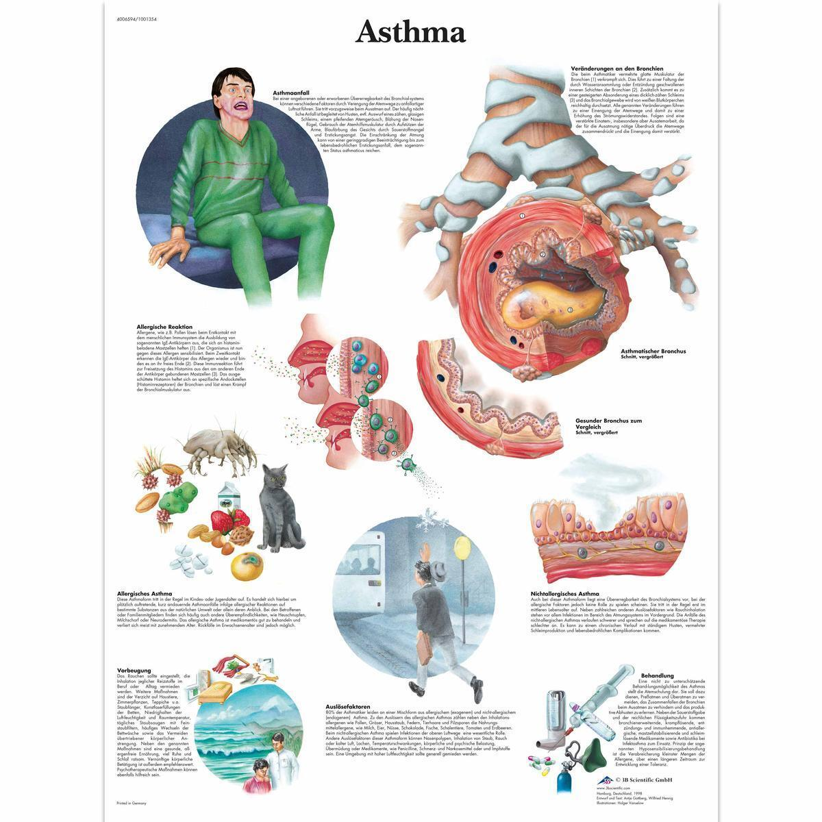 VR0328 L 01 1200 12001001354 Asthma Chart 1