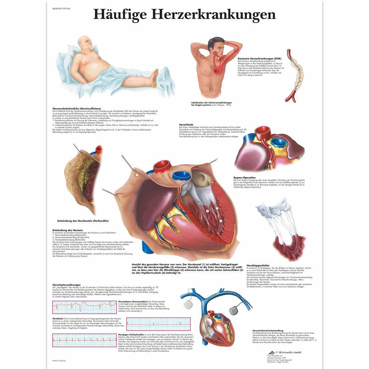 VR0343 L 01 1200 12001001362 Haeufige Herzerkrankun 1