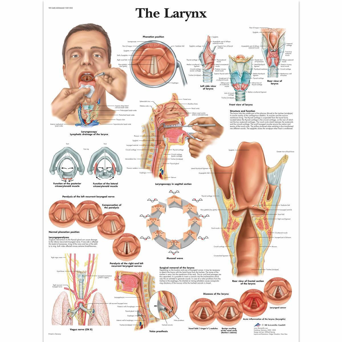 VR1248 L 01 1200 12001001502 The Larynx Chart