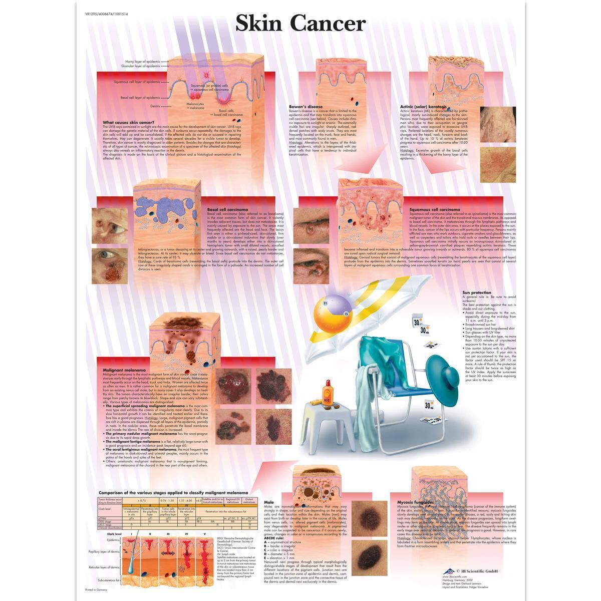 VR1295 L 01 1200 12001001514 Skin Cancer Chart 1