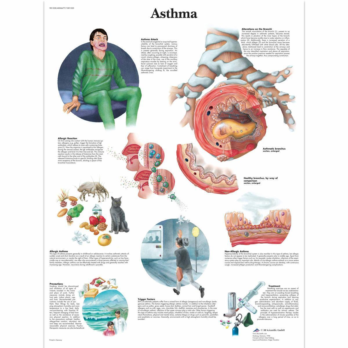 VR1328 L 01 1200 12001001520 Asthma Chart 1