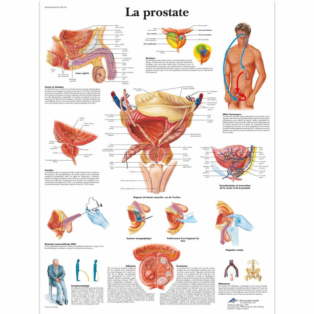 VR2528 L 01 1200 12001001733 La prostate