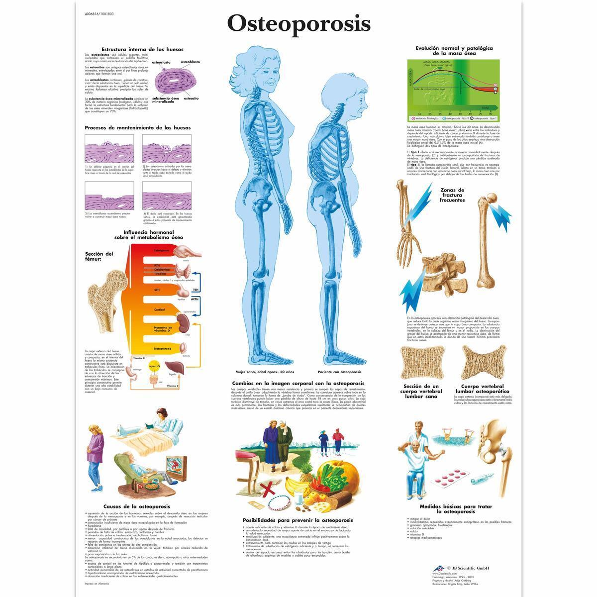 VR3121 L 01 1200 12001001803 Osteoporosis 1