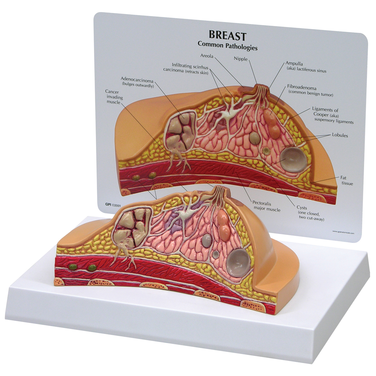 W33351 01 1200 12001019559 Breast Cross Section M